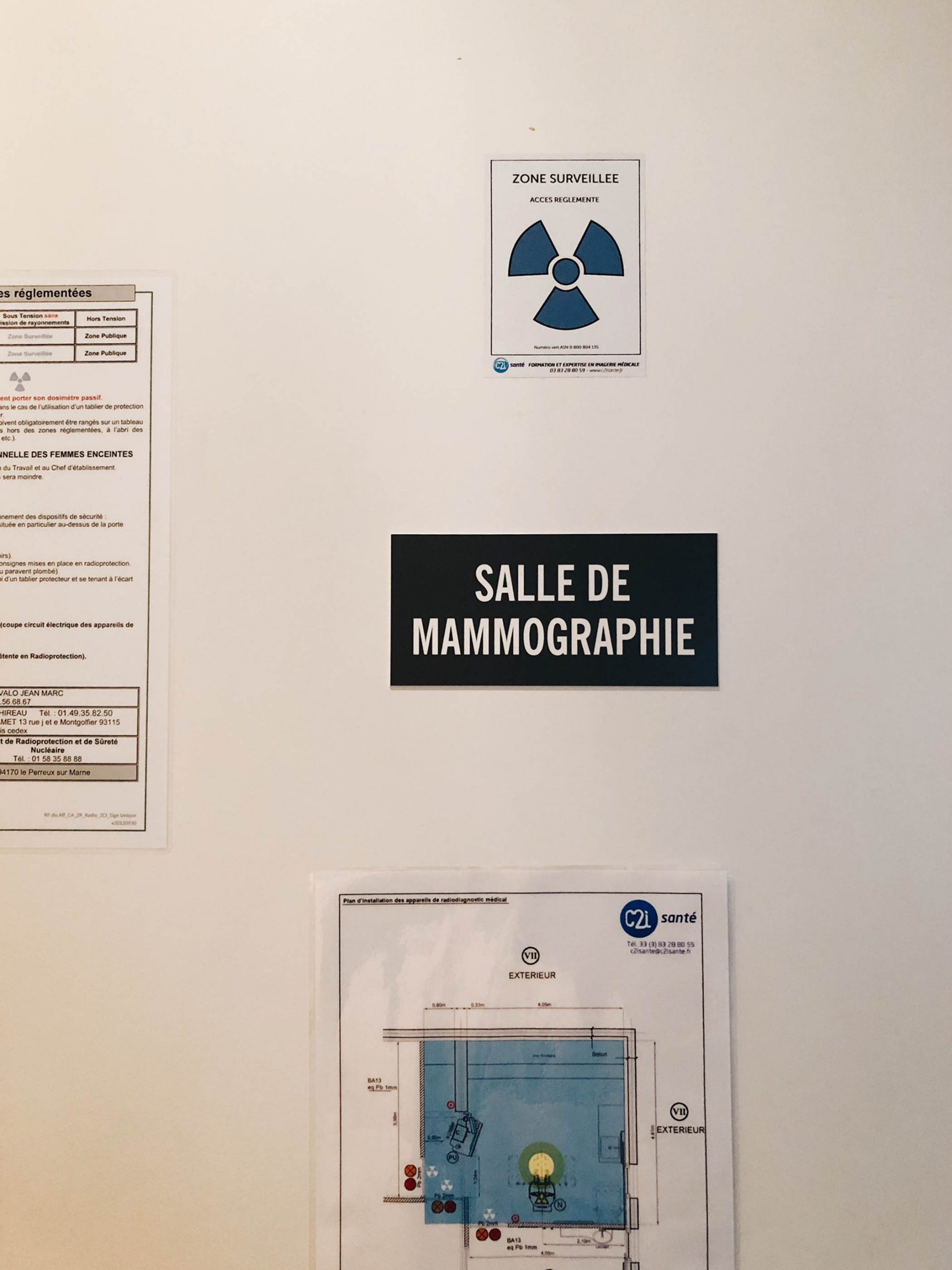 mammographie